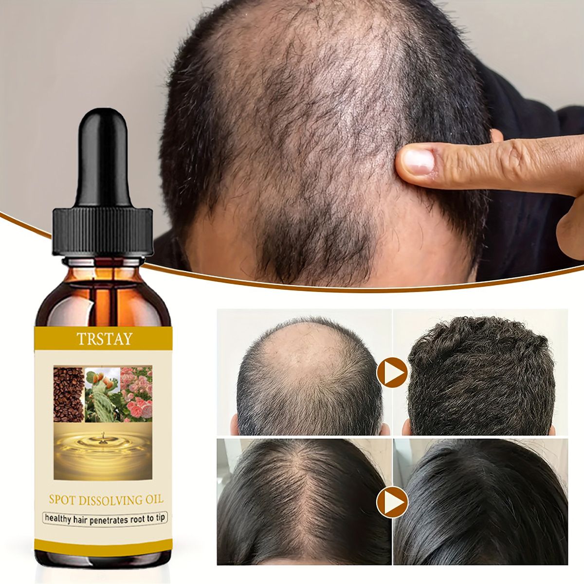 Beard Oil - 50ml óleo de crescimento de barba